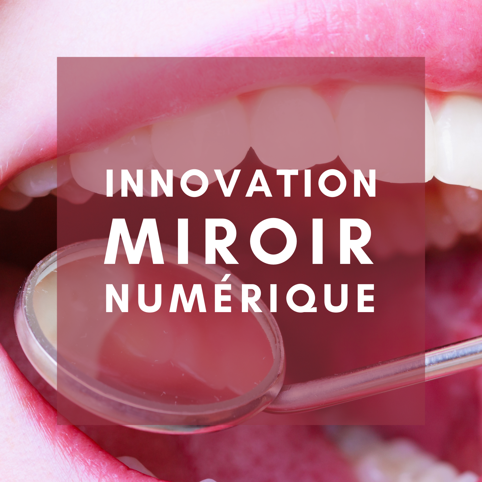 Set De Miroirs Dentaires Anti-brouillard Avec Lumière LED - Acier Inoxydable - Photographie Intra-orale - Neuf