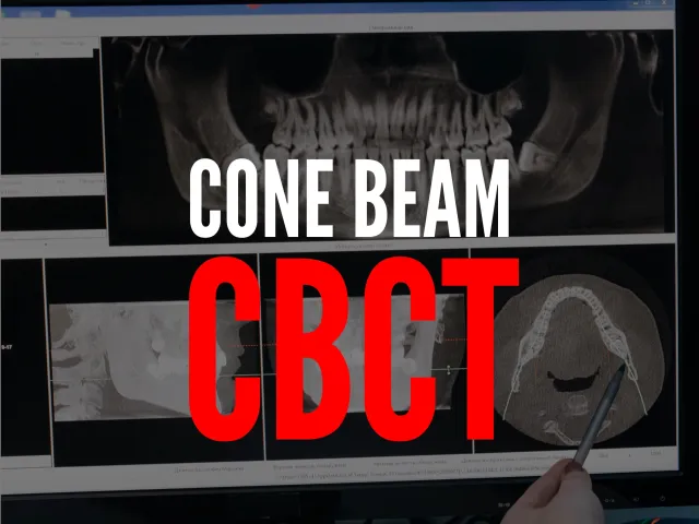 Vérifications sur le remboursement du code beam (CBCT)