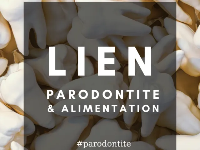 L’indice inflammatoire alimentaire (indice DII) est-il en relation avec les concentrations de cytokines salivaires et la parodontite ?