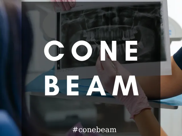 Cône Beam : des NRD bientôt !