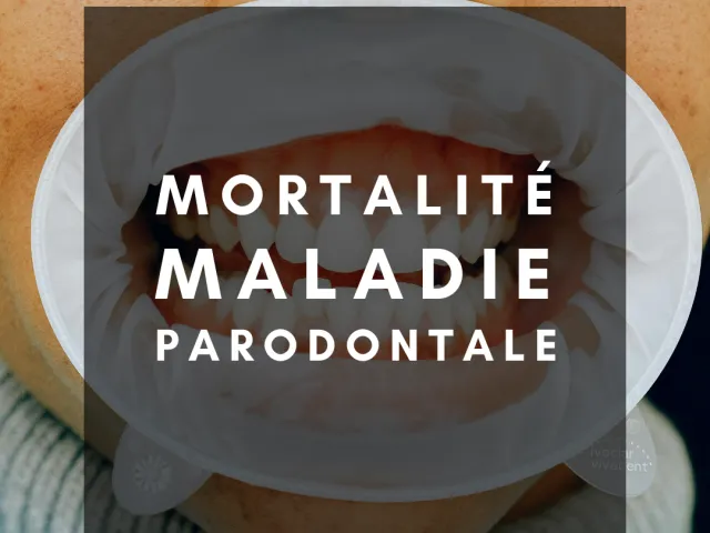 Causes de mortalité chez les adultes américains atteints de maladies parodontales