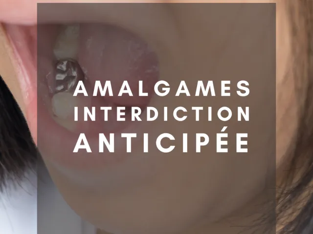 Interdiction des amalgames dentaires : anticipée en 2025 ! 
