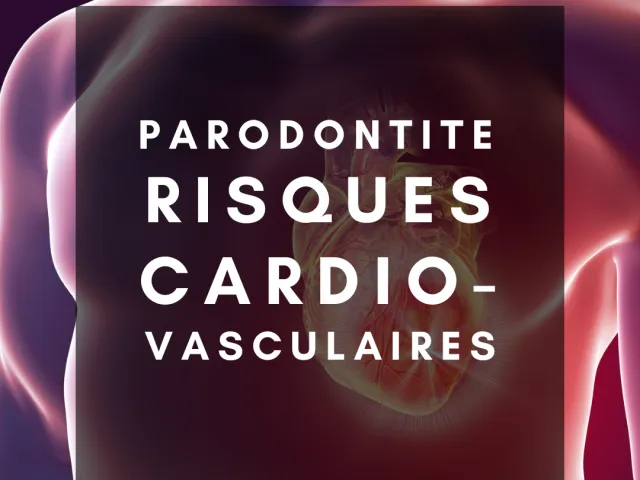 La parodontite augmente-t-elle le risque d’événements cardiovasculaires futurs* ?