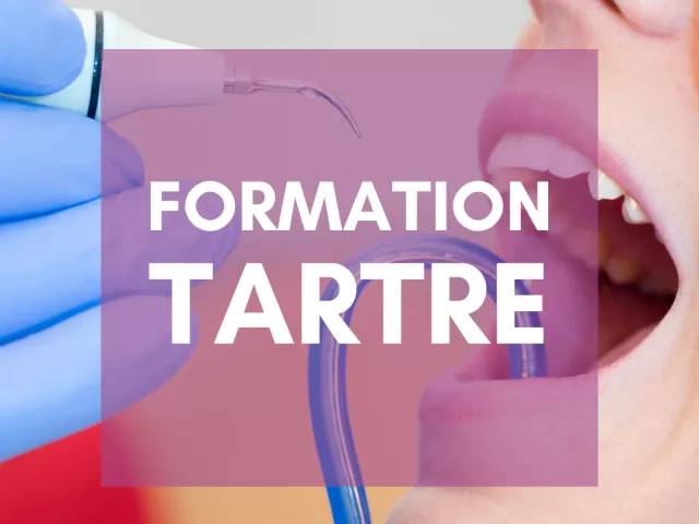 Taux de formation du tartre dentaire